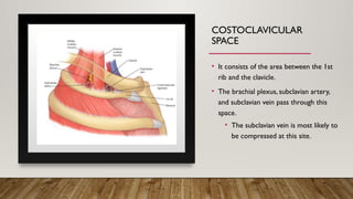 Thoracic Outlet Syndrome Review and Guidelines | PPT