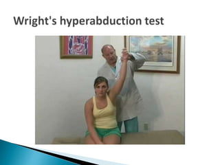 Thoracic outlet syndrome | PPTX