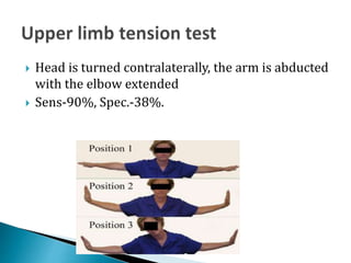 Thoracic outlet syndrome | PPTX