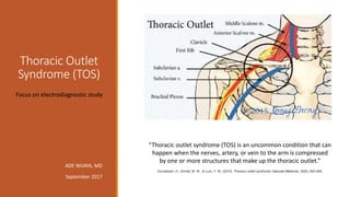 Thoracic Outlet
Syndrome (TOS)
ADE WIJAYA, MD
September 2017
“Thoracic outlet syndrome (TOS) is an uncommon condition that can
happen when the nerves, artery, or vein to the arm is compressed
by one or more structures that make up the thoracic outlet.”
Grunebach, H., Arnold, M. W., & Lum, Y. W. (2015). Thoracic outlet syndrome.Vascular Medicine, 20(5), 493-495.
Focus on electrodiagnostic study
 
