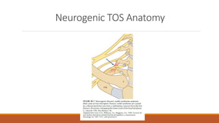 Thoracic Outlet Syndrome; Focus on Electrodiagnostic Studies | PPT