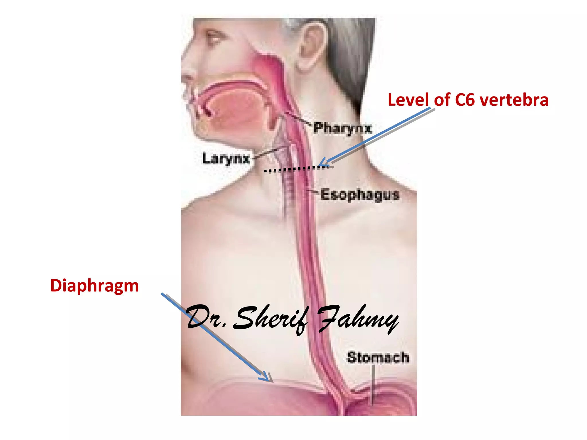 Level of C6 vertebra
Diaphragm
Dr.Sherif Fahmy
 