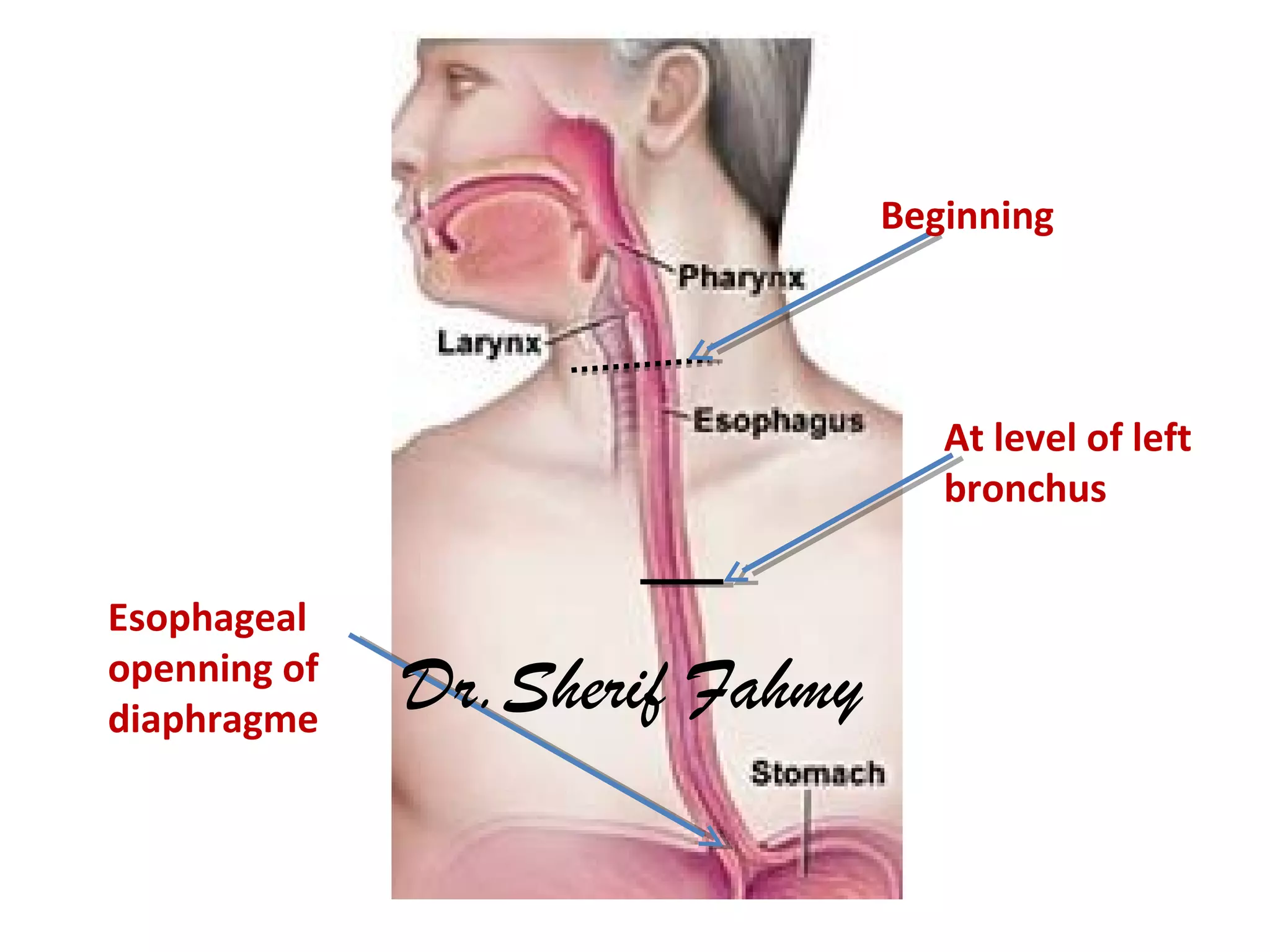 Beginning
Esophageal
openning of
diaphragme
At level of left
bronchus
Dr.Sherif Fahmy
 
