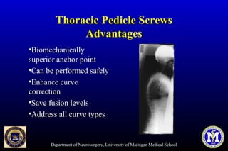 Department of Neurosurgery, University of Michigan Medical School
Thoracic Pedicle ScrewsThoracic Pedicle Screws
AdvantagesAdvantages
•BiomechanicallyBiomechanically
superior anchor pointsuperior anchor point
•Can be performed safelyCan be performed safely
•Enhance curveEnhance curve
correctioncorrection
•Save fusion levelsSave fusion levels
•Address all curve typesAddress all curve types
 