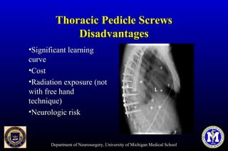Department of Neurosurgery, University of Michigan Medical School
Thoracic Pedicle ScrewsThoracic Pedicle Screws
DisadvantagesDisadvantages
•Significant learningSignificant learning
curvecurve
•CostCost
•Radiation exposure (notRadiation exposure (not
with free handwith free hand
technique)technique)
•Neurologic riskNeurologic risk
 