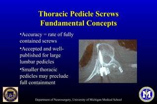 Department of Neurosurgery, University of Michigan Medical School
Thoracic Pedicle ScrewsThoracic Pedicle Screws
Fundamental ConceptsFundamental Concepts
•Accuracy = rate of fullyAccuracy = rate of fully
contained screwscontained screws
•Accepted and well-Accepted and well-
published for largepublished for large
lumbar pedicleslumbar pedicles
•Smaller thoracicSmaller thoracic
pedicles may precludepedicles may preclude
full containmentfull containment
 