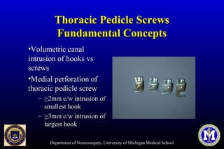 Department of Neurosurgery, University of Michigan Medical School
Thoracic Pedicle ScrewsThoracic Pedicle Screws
Fundamental ConceptsFundamental Concepts
•Volumetric canalVolumetric canal
intrusion of hooks vsintrusion of hooks vs
screwsscrews
•Medial perforation ofMedial perforation of
thoracic pedicle screwthoracic pedicle screw
– >>2mm c/w intrusion of2mm c/w intrusion of
smallest hooksmallest hook
– >>3mm c/w intrusion of3mm c/w intrusion of
largest hooklargest hook
 