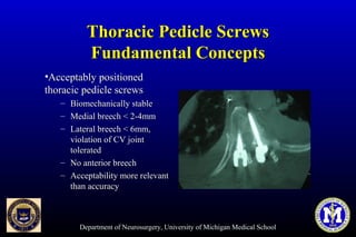 Department of Neurosurgery, University of Michigan Medical School
Thoracic Pedicle ScrewsThoracic Pedicle Screws
Fundamental ConceptsFundamental Concepts
•Acceptably positionedAcceptably positioned
thoracic pedicle screwsthoracic pedicle screws
– Biomechanically stableBiomechanically stable
– Medial breech < 2-4mmMedial breech < 2-4mm
– Lateral breech < 6mm,Lateral breech < 6mm,
violation of CV jointviolation of CV joint
toleratedtolerated
– No anterior breechNo anterior breech
– Acceptability more relevantAcceptability more relevant
than accuracythan accuracy
 