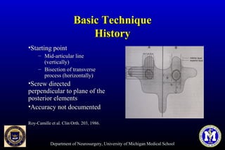 Department of Neurosurgery, University of Michigan Medical School
Basic TechniqueBasic Technique
HistoryHistory
•Starting pointStarting point
– Mid-articular lineMid-articular line
(vertically)(vertically)
– Bisection of transverseBisection of transverse
process (horizontally)process (horizontally)
•Screw directedScrew directed
perpendicular to plane of theperpendicular to plane of the
posterior elementsposterior elements
•Accuracy not documentedAccuracy not documented
Roy-Camille et al. Clin Orth. 203, 1986.Roy-Camille et al. Clin Orth. 203, 1986.
 