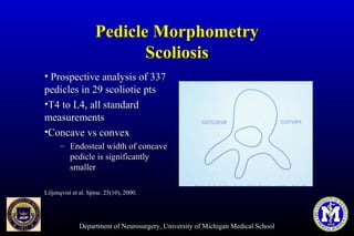 Department of Neurosurgery, University of Michigan Medical School
Pedicle MorphometryPedicle Morphometry
ScoliosisScoliosis
• Prospective analysis of 337Prospective analysis of 337
pedicles in 29 scoliotic ptspedicles in 29 scoliotic pts
•T4 to L4, all standardT4 to L4, all standard
measurementsmeasurements
•Concave vs convexConcave vs convex
– Endosteal width of concaveEndosteal width of concave
pedicle is significantlypedicle is significantly
smallersmaller
Liljenqvist et al. Spine. 25(10), 2000.Liljenqvist et al. Spine. 25(10), 2000.
 