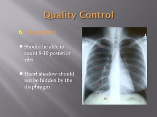  6. Inspiration
 Should be able to
count 9-10 posterior
ribs
 Heart shadow should
not be hidden by the
diaphragm
1
2
3
4
5
6
7
8
9
10
 