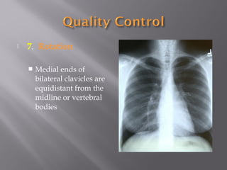  7. Rotation
 Medial ends of
bilateral clavicles are
equidistant from the
midline or vertebral
bodies
 