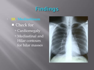  10. Mediastinum
 Check for
 Cardiomegaly
 Mediastinal and
Hilar contours
for hilar masses
 