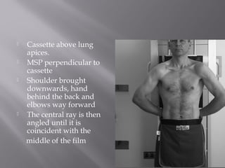  Cassette above lung
apices.
 MSP perpendicular to
cassette
 Shoulder brought
downwards, hand
behind the back and
elbows way forward
 The central ray is then
angled until it is
coincident with the
middle of the film
 