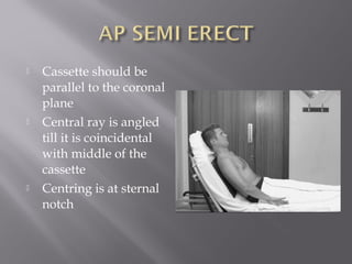  Cassette should be
parallel to the coronal
plane
 Central ray is angled
till it is coincidental
with middle of the
cassette
 Centring is at sternal
notch
 
