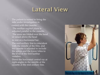  The patient is turned to bring the
side under investigation in
contact with the cassette.
 The median sagittal plane is
adjusted parallel to the cassette.
 The arms are folded over the head
or raised above the head
to rest on a horizontal bar.
 The mid-axillary line is coincident
with the middle of the film, and
the cassette is adjusted to include
the apices and the lower lobes to
the level of the first lumbar
vertebra.
 Direct the horizontal central ray at
right-angles to the middle of the
cassette at the mid-axillary line.
 