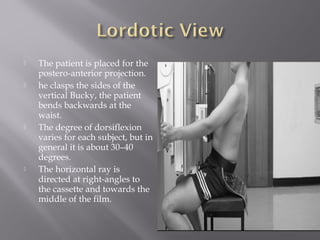  The patient is placed for the
postero-anterior projection.
 he clasps the sides of the
vertical Bucky, the patient
bends backwards at the
waist.
 The degree of dorsiflexion
varies for each subject, but in
general it is about 30–40
degrees.
 The horizontal ray is
directed at right-angles to
the cassette and towards the
middle of the film.
 