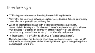 Thoracic radiological signs | PPTX