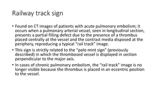 Thoracic radiological signs | PPTX