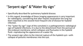 Putrid Sign Thoracic radiological signs | PPTX