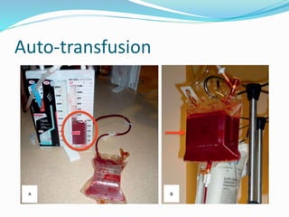 Thoracic trauma | PPTX