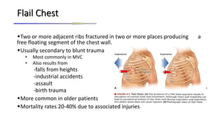 Thoracic trauma | PPTX