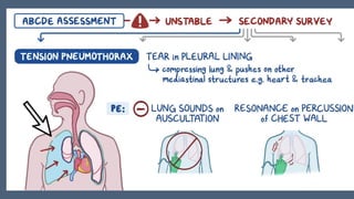 Blunt chest trauma part - 1. Presentation and approach to patient | PPTX
