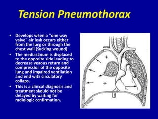 Tension Pneumothorax
• Develops when a "one way
  valve" air leak occurs either
  from the lung or through the
  chest wal...