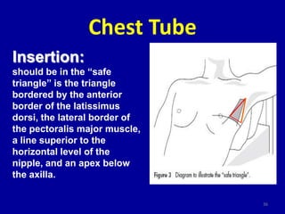 Chest Tube
Insertion:
should be in the “safe
triangle” is the triangle
bordered by the anterior
border of the latissimus
d...
