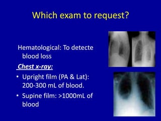 Which exam to request?


 Hematological: To detecte
  blood loss
 Chest x-ray:
• Upright film (PA & Lat):
  200-300 mL of ...