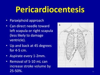 Pericardiocentesis
• Paraxiphoid approach
• Can direct needle toward
  left scapula or right scapula
  (less likely to dam...