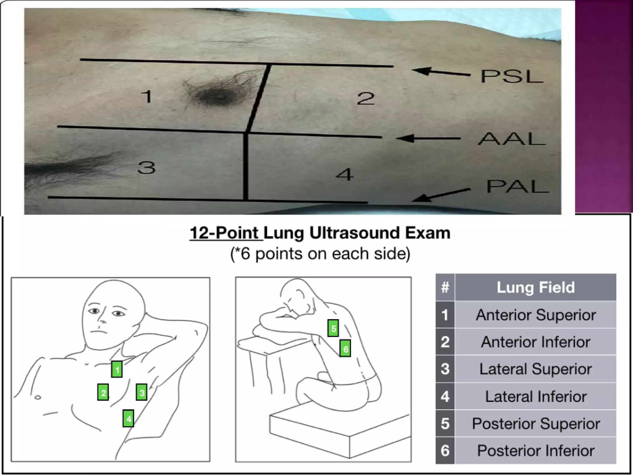 Thoracic ultrasonography ULTIMATE | PPTX