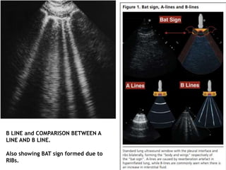 Thoracic ultrasonography ULTIMATE | PPTX