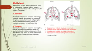 Flail Rips Thoracic wall l4 dr kandil | PPTX