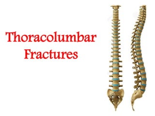 Thoracolumbar
Fractures
 