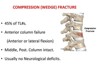 • 45% of TL#s.
• Anterior column failure
(Anterior or lateral flexion)
• Middle, Post. Column intact.
• Usually no Neurological deficits.
COMPRESSION (WEDGE) FRACTURE
 