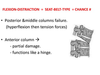 FLEXION-DISTRACTION = SEAT-BELT-TYPE = CHANCE #
• Posterior &middle columns failure.
(hyperflexion then tension forces)
• Anterior column 
- partial damage.
- functions like a hinge.
 