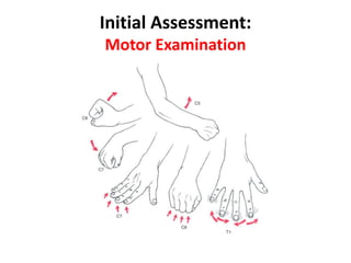 Initial Assessment:
Motor Examination
 