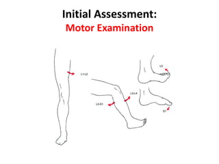 Initial Assessment:
Motor Examination
 