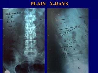 PPLLAAIINN XX--RRAAYYSS 
 