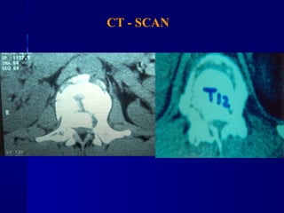 CT - SCAN 
 