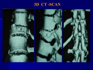 3D CT -SCAN 
 