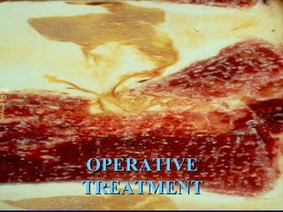 OOPPEERRAATTIIVVEE 
TTRREEAATTMMEENNTT 
 