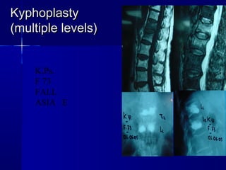 KKyypphhooppllaassttyy 
((mmuullttiippllee lleevveellss)) 
K.Ps. 
F 73 
FALL 
ASIA E 
 