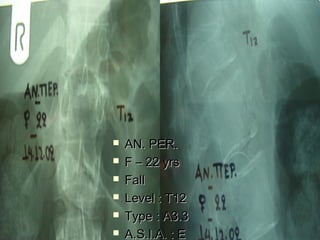  AANN.. PPEERR.. 
 FF –– 2222 yyrrss 
 FFaallll 
 LLeevveell :: TT1122 
 TTyyppee :: AA33..33 
 AA..SS..II..AA.. :: EE 
 