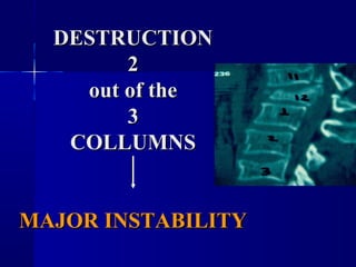 DDEESSTTRRUUCCTTIIOONN 
22 
oouutt ooff tthhee 
33 
CCOOLLLLUUMMNNSS 
MMAAJJOORR IINNSSTTAABBIILLIITTYY 
 