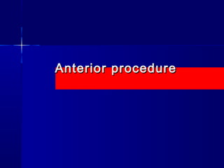 AAnntteerriioorr pprroocceedduurree 
 