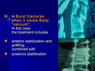 IIIIII.. IInn BBuurrsstt ffrraaccttuurreess 
wwhheenn iitt eexxiissttss BBooddyy 
““vvaaccuuuumm””.. 
IInn tthhiiss ccaassee 
tthhee ttrreeaattmmeenntt iinncclluuddeess 
aanntteerriioorr ssttaabbiilliizzaattiioonn aanndd 
ggrraaffttiinngg,, 
ccoommbbiinneedd wwiitthh 
ppoosstteerriioorr ssttaabbiilliizzaattiioonn 
 