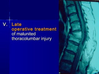 VV.. LLaattee 
ooppeerraattiivvee ttrreeaattmmeenntt 
ooff mmaalluunniitteedd 
tthhoorraaccoolluummbbaarr iinnjjuurryy 
 