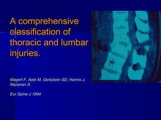 AA ccoommpprreehheennssiivvee 
ccllaassssiiffiiccaattiioonn ooff 
tthhoorraacciicc aanndd lluummbbaarr 
iinnjjuurriieess.. 
MMaaggeerrll FF,, AAeebbii MM,, GGeerrttzzbbeeiinn SSDD,, HHaarrmmss JJ,, 
NNaazzaarriiaann SS.. 
EEuurr SSppiinnee JJ 1199994 
 